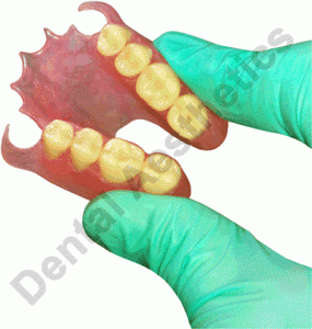 Valplast Flexible Denture